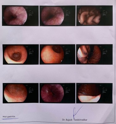 Endoscopy Report mod.jpg