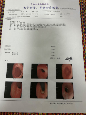 recent gastroscopy check-up.jpg